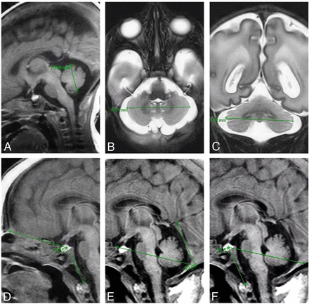 Fig 1.