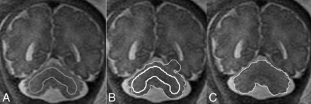 Fig 1.