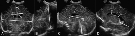 Fig 1.