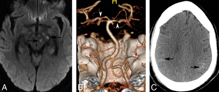 Fig 4.