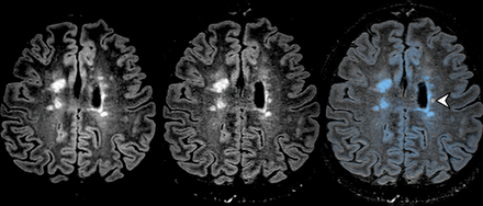 Fig 4.