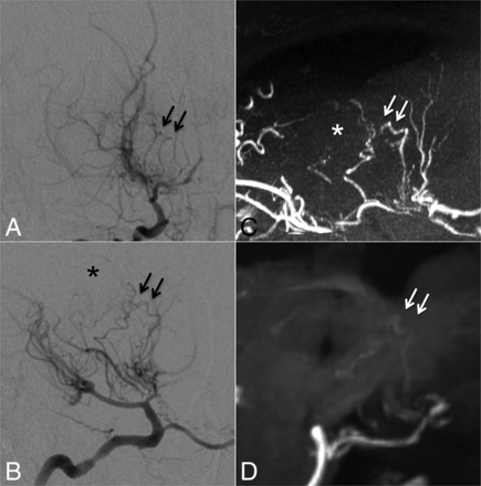 Fig 3.