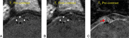 Fig 2.