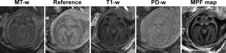 Fig 1.