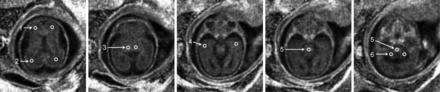 Fig 2.