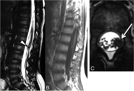 Fig 4.