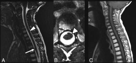 Fig 5.