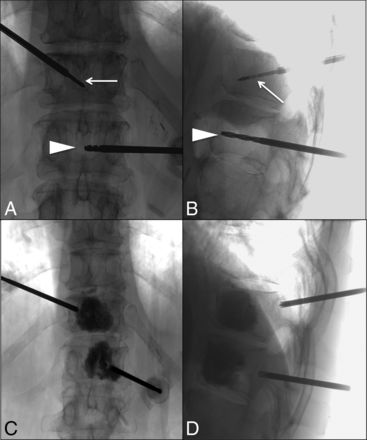 Fig 2.