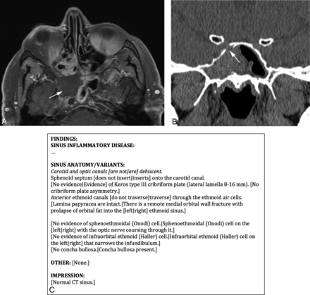 Fig 4.