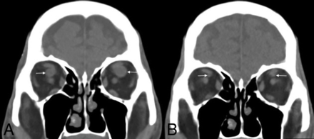 Fig 1.