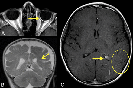 Fig 1.