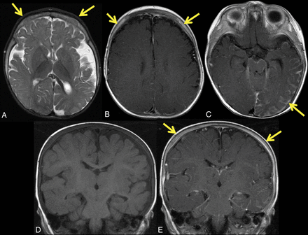 Fig 3.