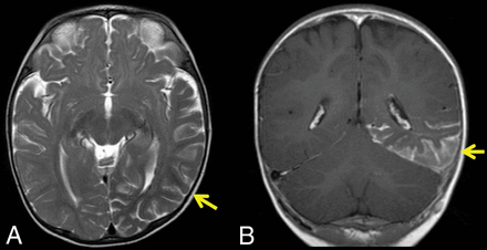 Fig 4.