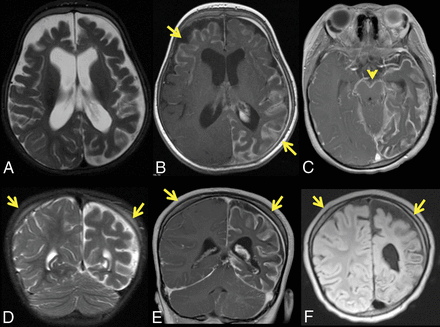 Fig 6.