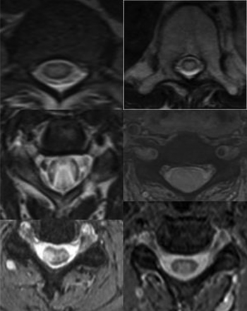 Fig 3.