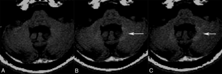 Fig 4.