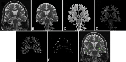 Fig 1.