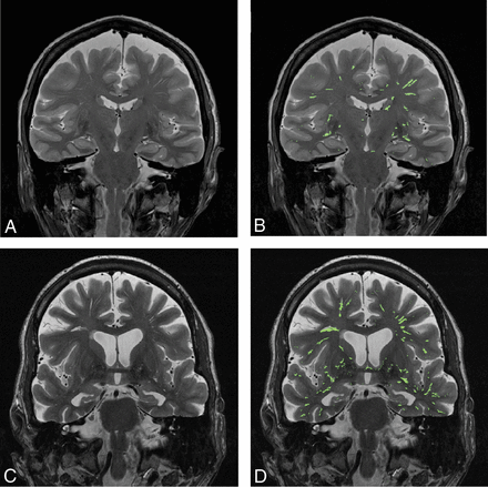 Fig 2.