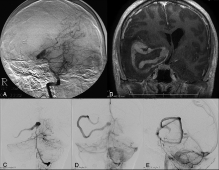 Fig 2.