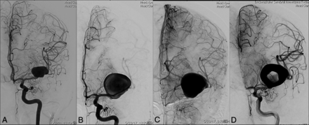 Fig 3.