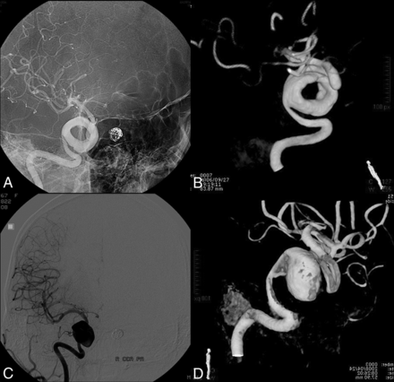 Fig 4.
