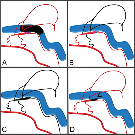 Fig 2.