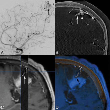 Fig 3.