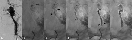 Fig 1.