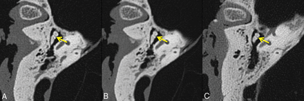 Fig 4.