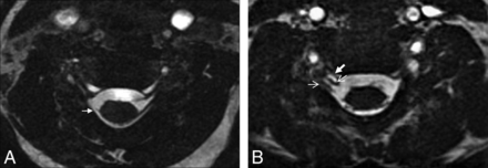 Fig 3.