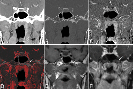 Fig 2.
