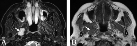 Fig 1.