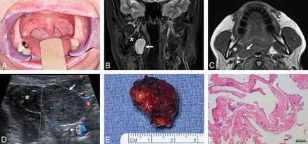 Fig 3.