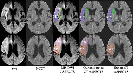 Fig 4.