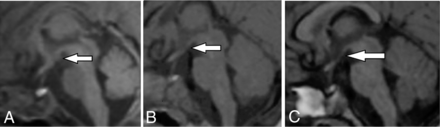 Fig 3.