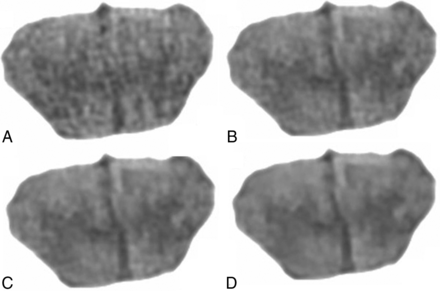 Fig 3.