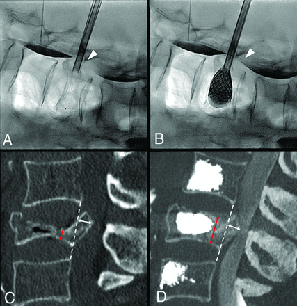 Fig 1.