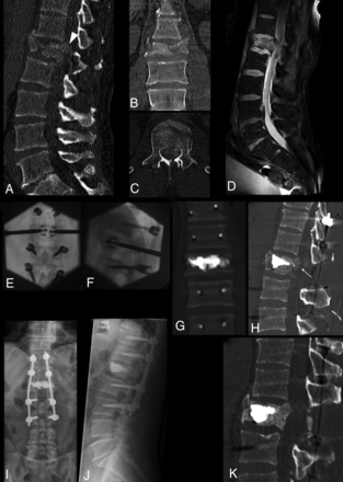 Fig 4.