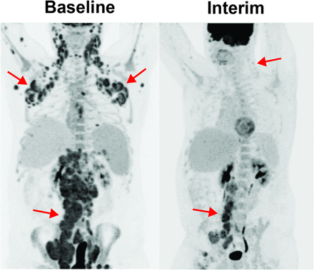 Fig 3.