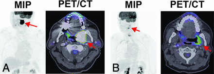 Fig 6.