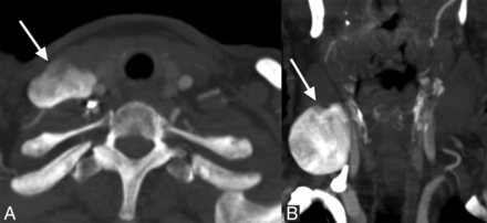 Fig 2.