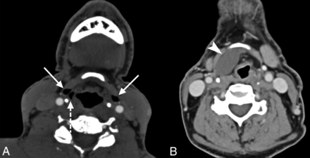 Fig 4.