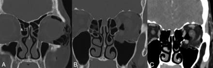 Fig 5.