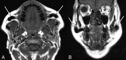 Fig 6.