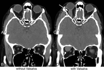 Fig 8.
