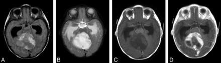 Fig 1.