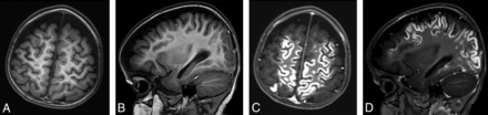 Fig 3.