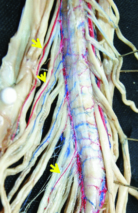 Fig 4.