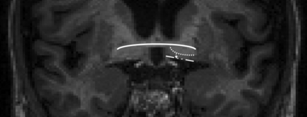 Fig 1.