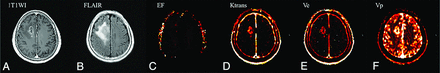 Fig 1.